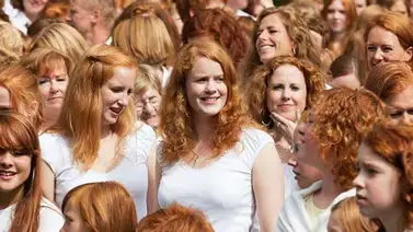 Los pelirrojos tienen más riesgo de cáncer de piel Los pelirrojos tienen más riesgo de cáncer de piel