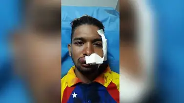 Violinista envía mensaje luego de ser herido en Altamira este sábado (+Video) Violinista envía mensaje luego de ser herido en Altamira este sábado (+Video)