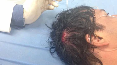 Herido en la cabeza Carlos Paparoni durante manifestación en la Francisco Fajardo (+Video)