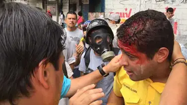 Hirieron en la cabeza al diputado José Manuel Olivares (+Fotos y video) Hirieron en la cabeza al diputado José Manuel Olivares (+Fotos y video)