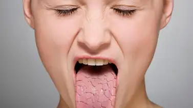 Signos subestimados: la deshidratación más allá de la sed Signos subestimados: la deshidratación más allá de la sed