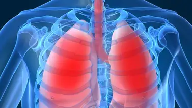 Pulmones | Límpialos fácilmente con estos ingredientes Pulmones | Límpialos fácilmente con estos ingredientes