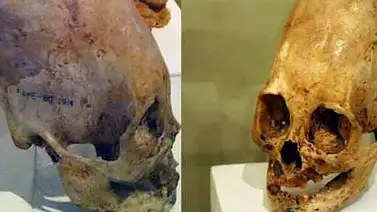 Hallan 6 cráneos deformes prehispánicos en envío postal de Perú a Canadá Hallan 6 cráneos deformes prehispánicos en envío postal de Perú a Canadá