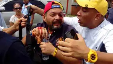 Marcha en Barinas culminó con cuatro heridos (+Fotos y video) Marcha en Barinas culminó con cuatro heridos (+Fotos y video)