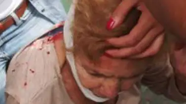 Reportan más de 20 heridos en manifestación de Mérida Reportan más de 20 heridos en manifestación de Mérida