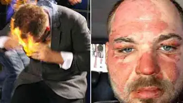 Arrestan al esposo de Adriana Azzi por quemar a un mago Arrestan al esposo de Adriana Azzi por quemar a un mago