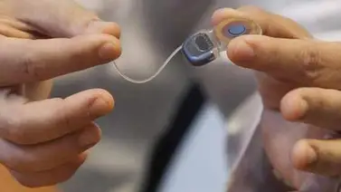 Científicos rusos inventan revestimiento de implantes antibacteriano Científicos rusos inventan revestimiento de implantes antibacteriano