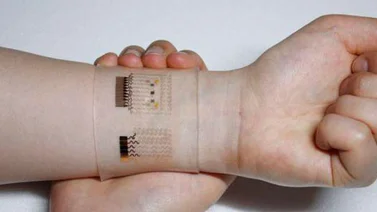 Desarrollan un parche que permite controlar la diabetes