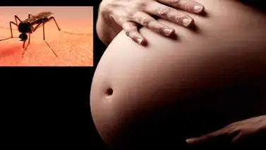 EEUU aconseja usar condón a mujeres embarazadas o en edad reproductiva por Zika EEUU aconseja usar condón a mujeres embarazadas o en edad reproductiva por Zika