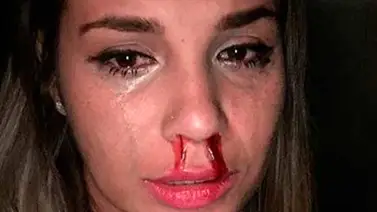 Magga Bracoviche: Víctima de la violencia doméstica Magga Bracoviche: Víctima de la violencia doméstica