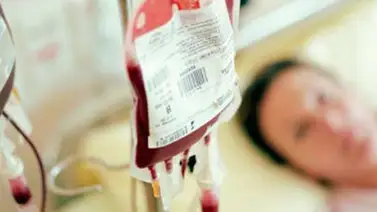 Anemia drepanocitica incide más en las costas Anemia drepanocitica incide más en las costas