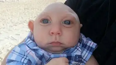 El niño que ha sobrevivido un año sin una parte de su cerebro El niño que ha sobrevivido un año sin una parte de su cerebro