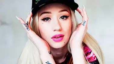 Iggy Azalea ha pasado por el quirófano varias veces Iggy Azalea ha pasado por el quirófano varias veces