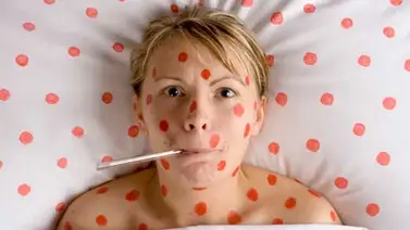 La lechina repunta en Caracas y Miranda La lechina repunta en Caracas y Miranda