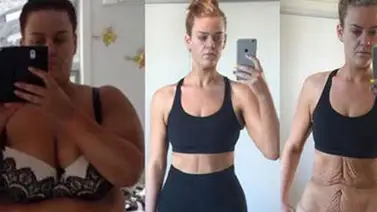 Mira el cambio extremo de esta mujer que bajó más de 80 kilos en un año Mira el cambio extremo de esta mujer que bajó más de 80 kilos en un año