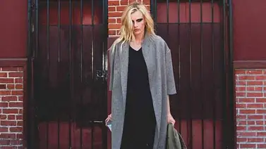 Modelo que le amputaron una pierna por el TSS Modelo que le amputaron una pierna por el TSS