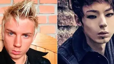 Cirugías extremas que te dejarán con la boca abierta Cirugías extremas que te dejarán con la boca abierta