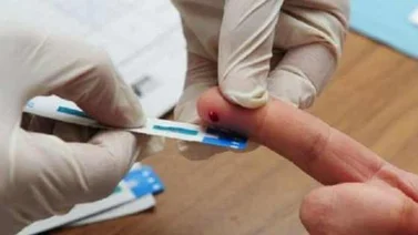 Primera prueba casera de SIDA