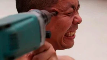 Hombre se taladra la cabeza y no muere en el intento