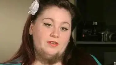 Mujer barbuda se hace famosa