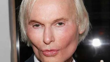 Murió el "Rey del Botox"