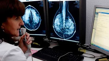 Tratamiento personalizado contra el cáncer tiene éxito en EEUU