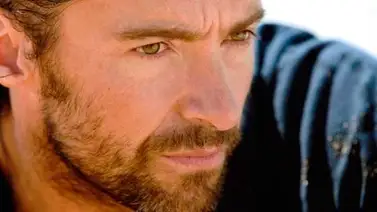 Hugh Jackman sufrió hemorragia en las cuerdas vocales Hugh Jackman sufrió hemorragia en las cuerdas vocales