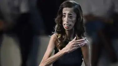 Lizzie Velásquez, "la mujer más fea del mundo" Lizzie Velásquez, "la mujer más fea del mundo"