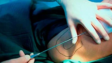 Instituto de Cirugía trabaja con normalidad luego de la muerte de una paciente