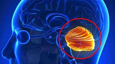 La joven china que probó que se puede vivir sin cerebelo