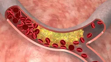 Diseñan pulsera que mide colesterol y triglicéridos Diseñan pulsera que mide colesterol y triglicéridos