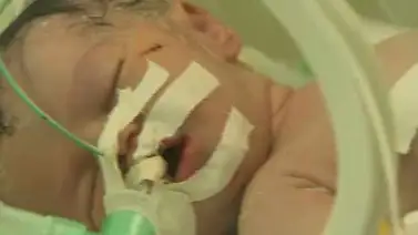 La niña que nació de una madre muerta en Gaza La niña que nació de una madre muerta en Gaza