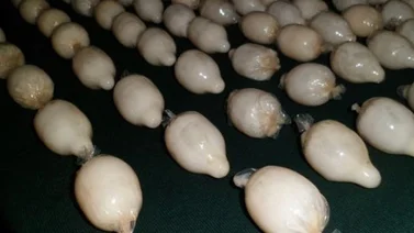 Murió luego de tragar 20 condones con drogas
