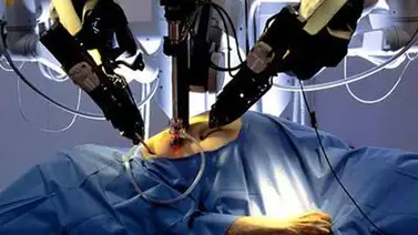 Cirujanos que operan a kilómetros de distancia Cirujanos que operan a kilómetros de distancia