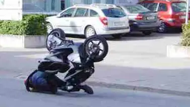 Reconstruyeron la cara destrozada de un hombre con impresora 3D Reconstruyeron la cara destrozada de un hombre con impresora 3D