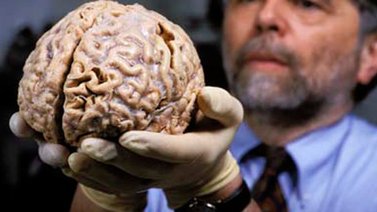 ¿Se encoge el cerebro con la edad?