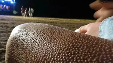 ¿Por qué nos ponen la piel de gallina algunas canciones? ¿Por qué nos ponen la piel de gallina algunas canciones?