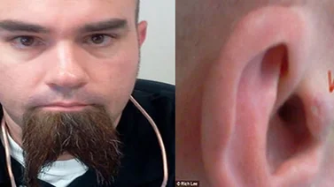 Se implanta auriculares en los oídos