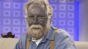 Muere "Papá Pitufo", el hombre con la piel azul Muere "Papá Pitufo", el hombre con la piel azul