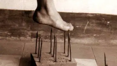 Niña que no siente dolor está inspirando los analgésicos del futuro Niña que no siente dolor está inspirando los analgésicos del futuro