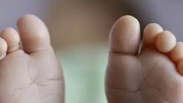 ¿Para qué sirve el dedo meñique del pie? ¿Para qué sirve el dedo meñique del pie?