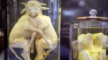 El insólito y horrible Museo Dupuytren de París El insólito y horrible Museo Dupuytren de París