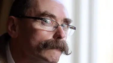 Clínicas estéticas turcas "se hacen de oro" con operaciones de implante de bigotes Clínicas estéticas turcas "se hacen de oro" con operaciones de implante de bigotes