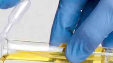 Identifican células madre en la orina humana. Identifican células madre en la orina humana.