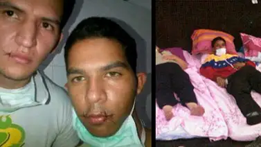 Estudiantes de la Universidad del Zulia se cosieron los labios Estudiantes de la Universidad del Zulia se cosieron los labios