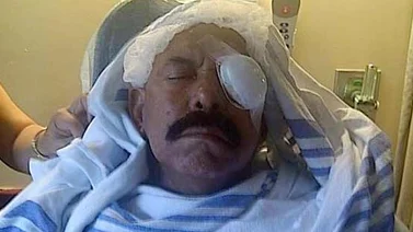 Oscar D’ León perdió la visión de su ojo izquierdo