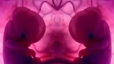 ¿Debería permitirse la clonación humana? ¿Debería permitirse la clonación humana?