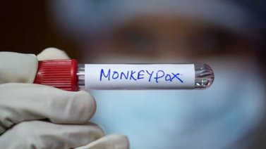 Detectan el primer caso autóctono de viruela del mono mpox en Argentina