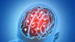 Así puedes prevenir la demencia vascular: sigue las recomendaciones de la Clínica Mayo de Estados Unidos