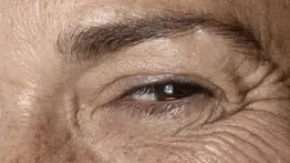 Susana Misticone: El melasma es testarudo, pero nosotros lo ayudamos a empeorar